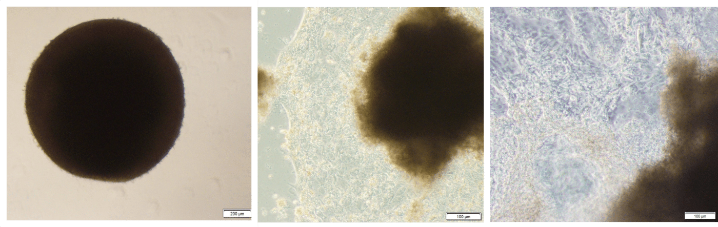 brightfield microscopy of maturing embryoids bodies