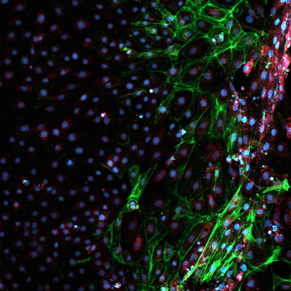 embryogenic protein expression merged